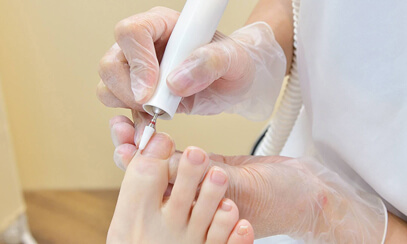 施術シーン：足の爪ケア