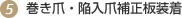 巻き爪・トラブル爪補正板装着